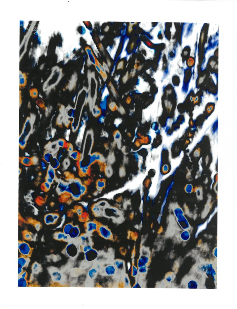 JS Abstract- Print